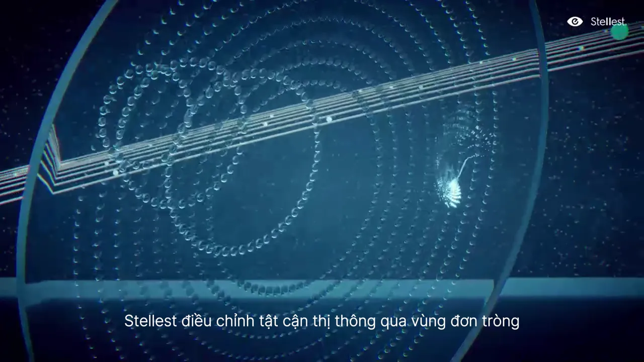 Vùng đơn tròng trung tâm điều chỉnh tật cận thị, cho thị lực sắc nét