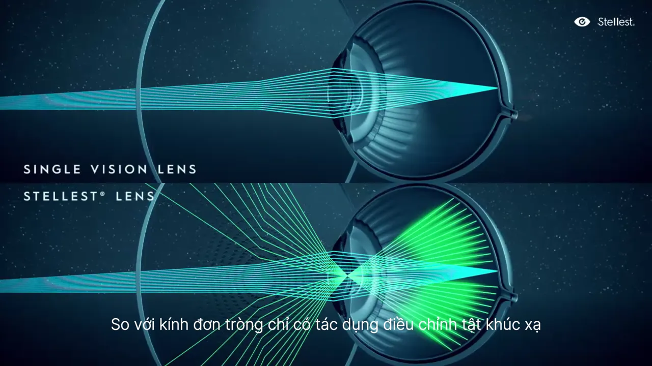 So với kính đơn tròng chỉ có tác dụng điều chỉnh tật khúc xạ